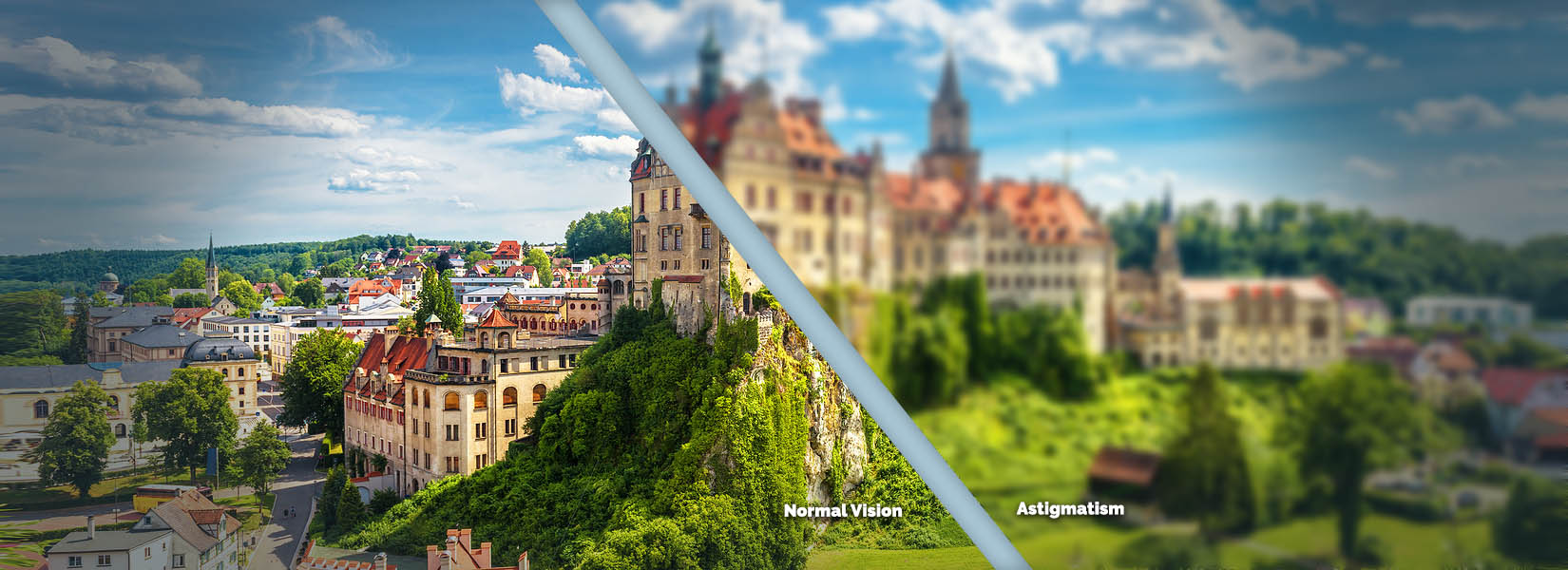 Astigmatism Treatment in City Park West