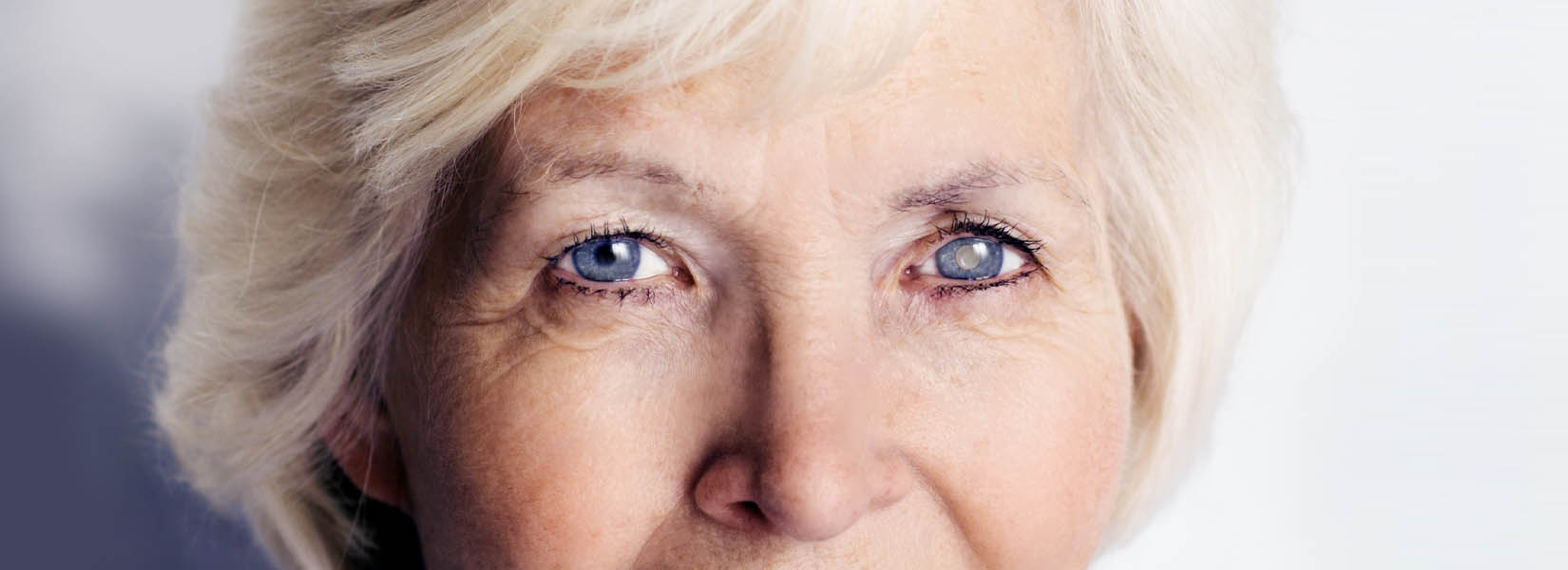 Cataract Surgery in City Park West